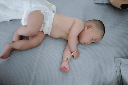 新沂宝宝上火有眼屎